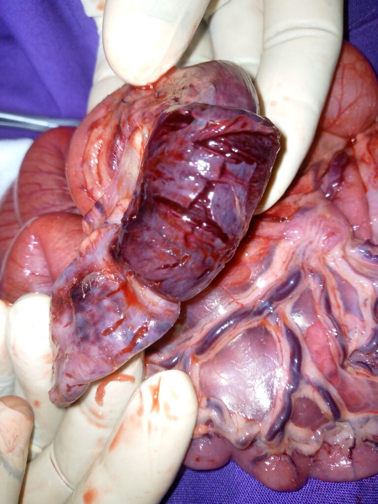 damaged intestine